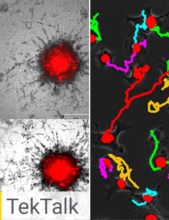 In Vitro Cell Migration Assays