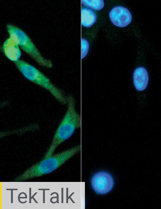 Automated Nuclear Translocation Assays