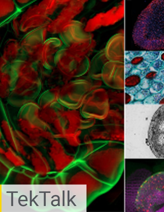 Confocal Fluorescence Imaging