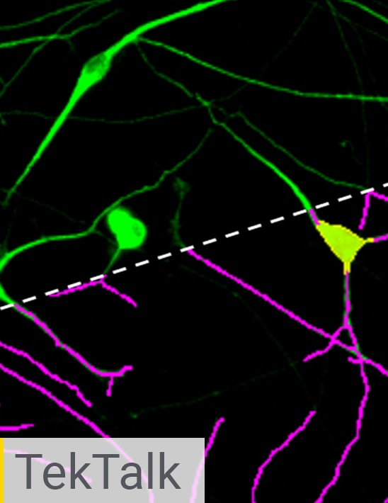 Neurite Outgrowth: Advancing Neurobiology Research with a Powerful Automated Solution