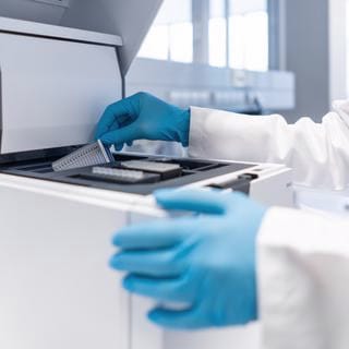 Cell-free DNA ScreenTape Analysis